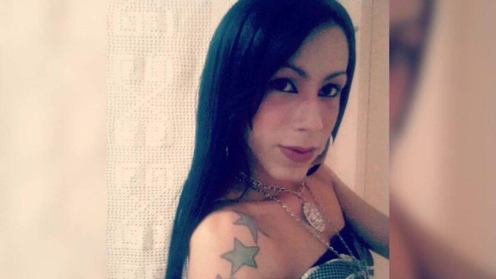 O que aconteceu com o rosto de influenciadora que precisou passar por cirurgia reparadora (Foto: Redes sociais/Reprodução)